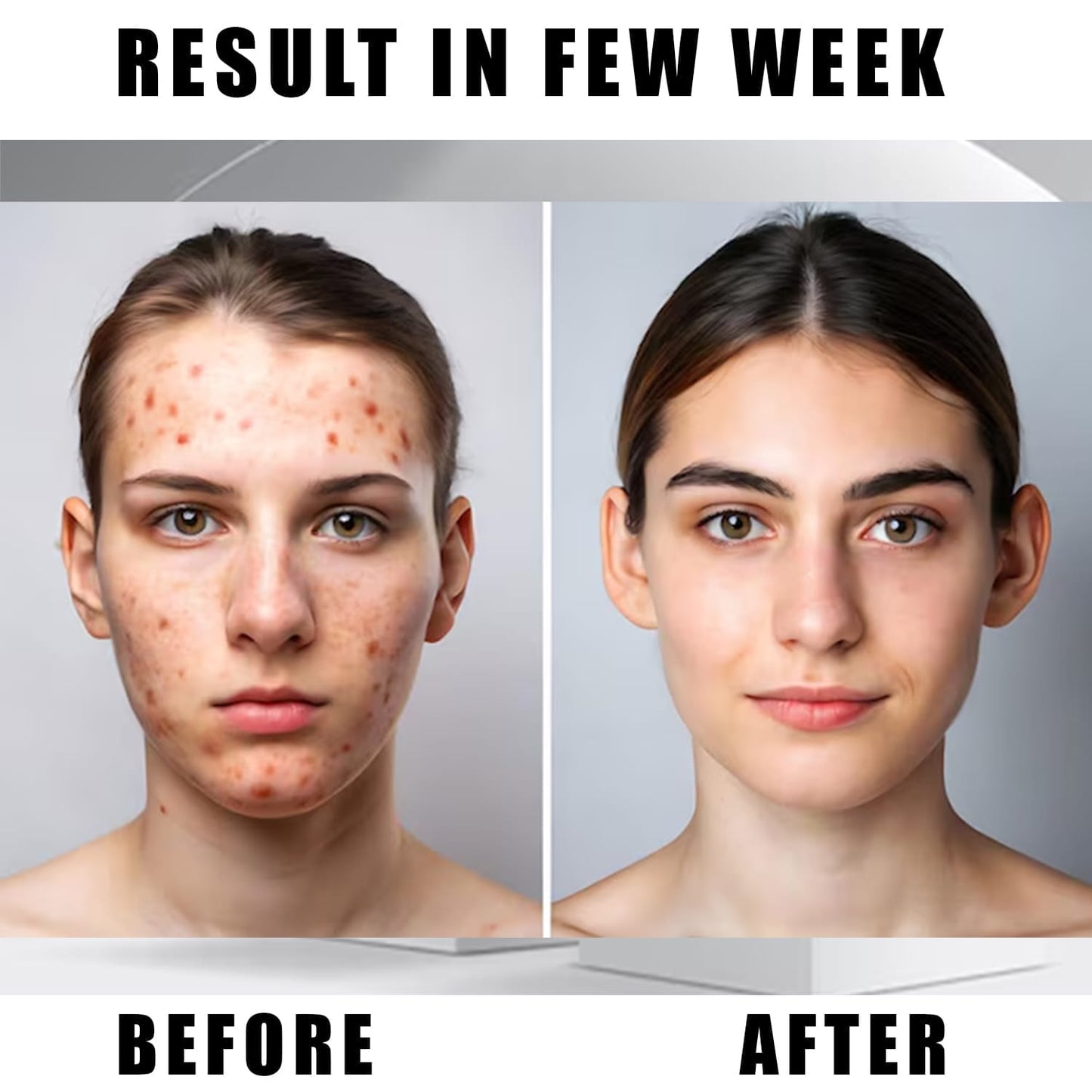 Niacinamide Acid Serum