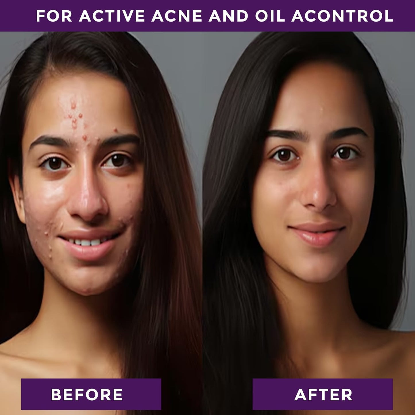 Salicylic Acid Face Serum